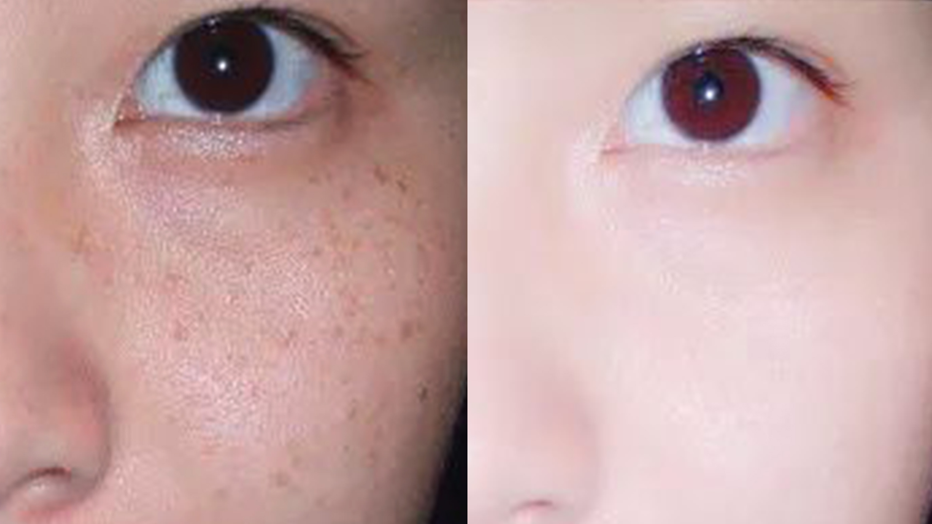 斑怎么保养才能淡,斑的处理方法