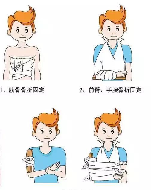 孩子骨折手术，术后护理同样不可忽视