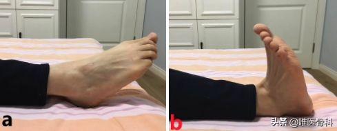 干货！骨折术后患者如何进行居家康复训练？