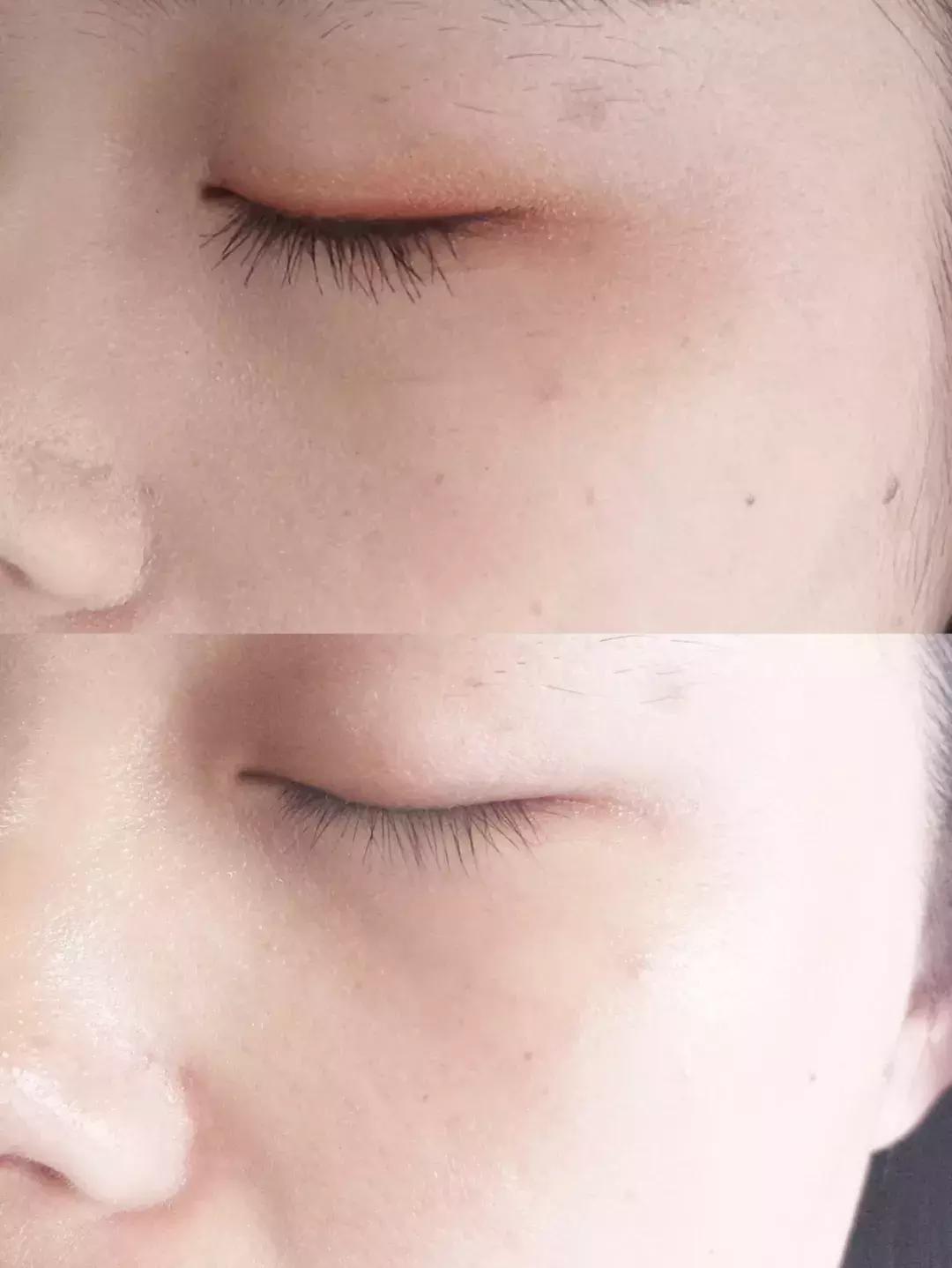 性价比卸妆水排行榜10强,高性价比卸妆产品推荐