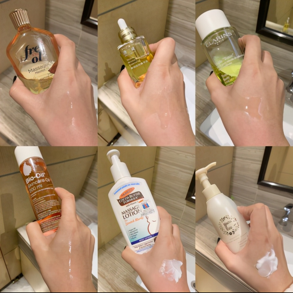 怎么才可以预防妊娠纹的出现,如何预防妊娠纹最有效