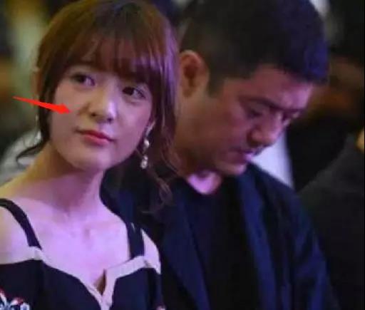 法令纹显老10岁三种方法帮助改善,最显老的法令纹怎么改善