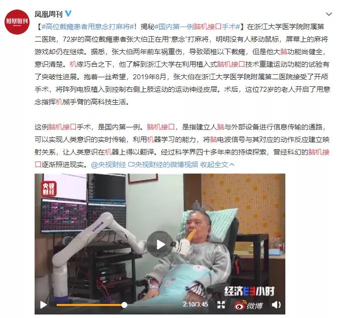 疼疼疼！截掉的胳膊，为什么感觉它还在动？
