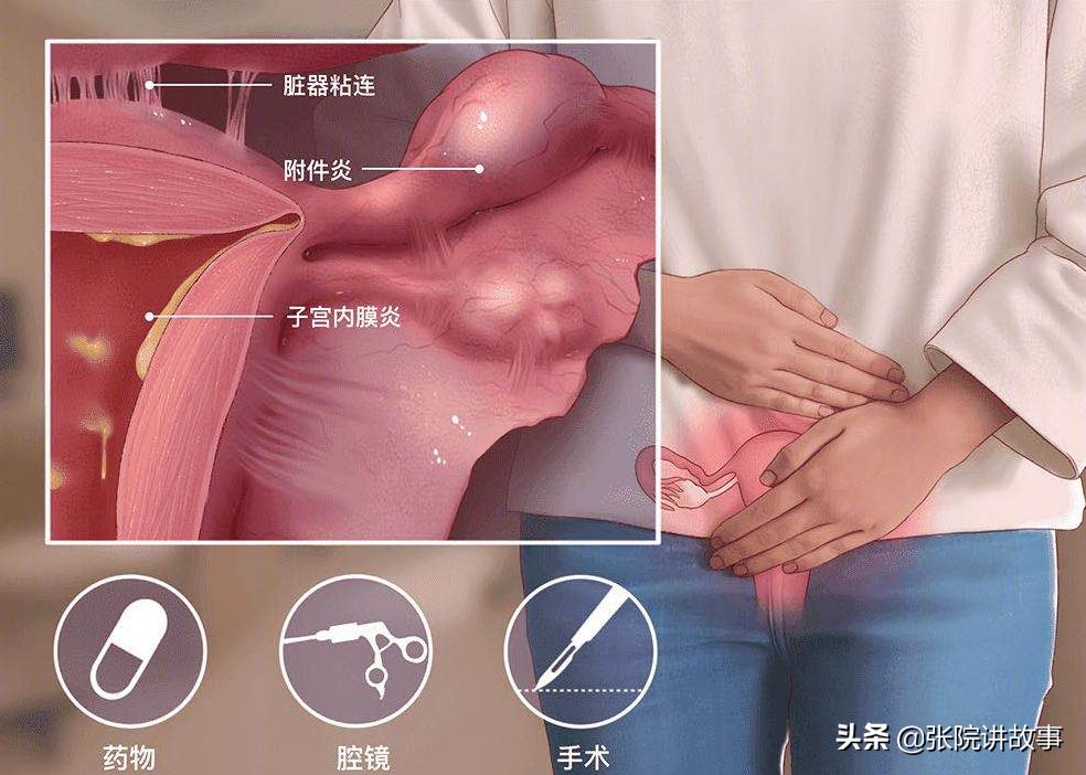 张院讲短视频,张院最新视频