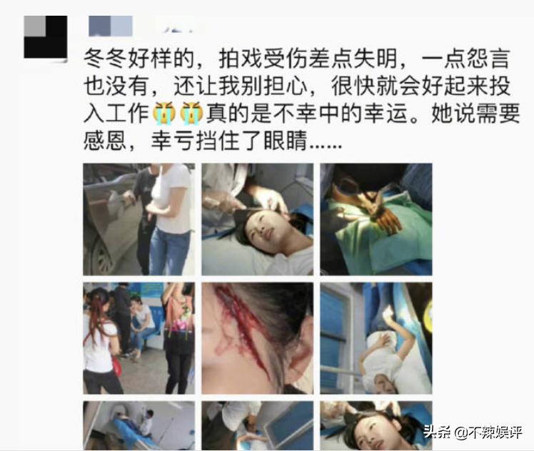 绯闻缠身的徐冬冬，被爆整形医院出事故，被紧急送往抢救