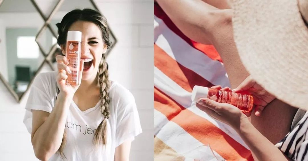 去妊娠纹的油有效果吗,去妊娠纹的油推荐