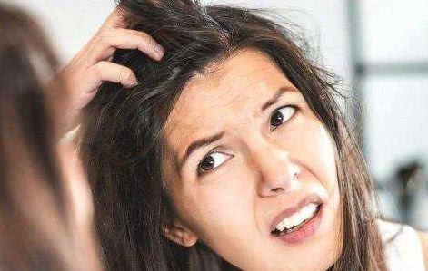 头发2天不洗就油是怎么回事,头发2天不洗头痒怎么回事