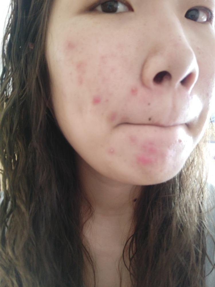 美女天天敷面膜皮肤却起皮，谁说补水只能敷面膜？可别花冤枉钱了