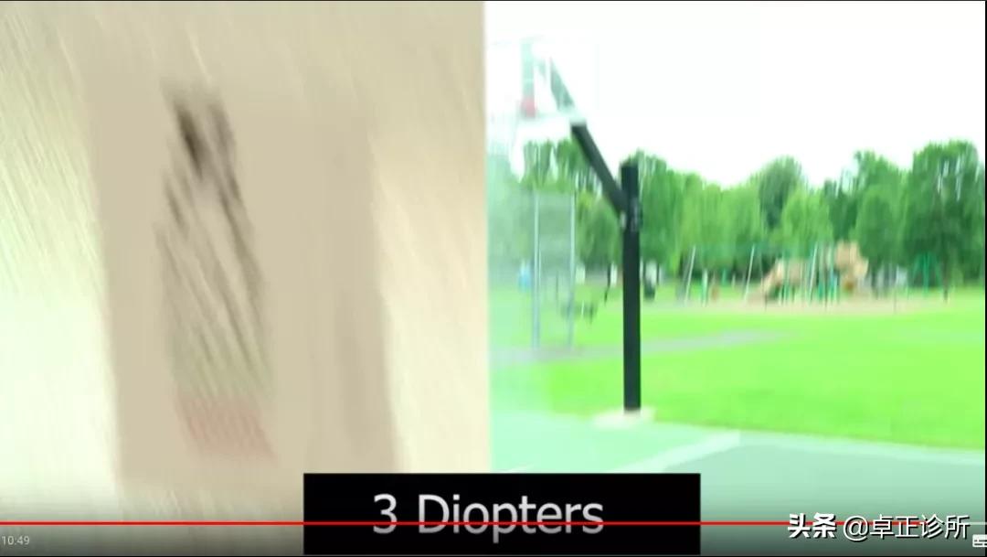 怎么按摩眼睛改善散光,怎么锻炼眼睛能改善散光