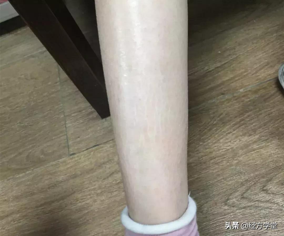 小儿感冒久治不好,小儿感冒反复发烧怎么办