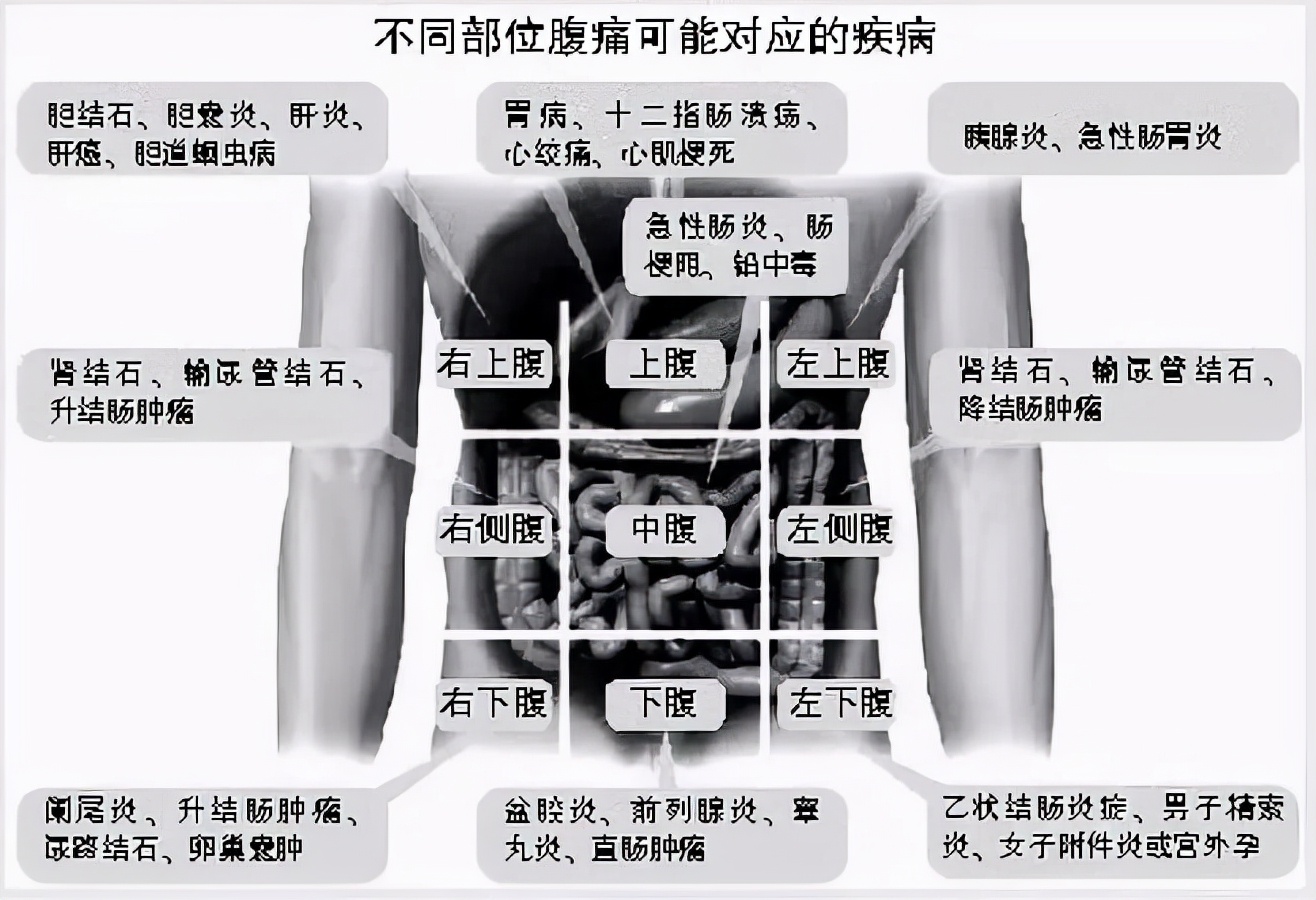 老生常谈和人尽皆知区别,胆结石跟胃病有关系吗