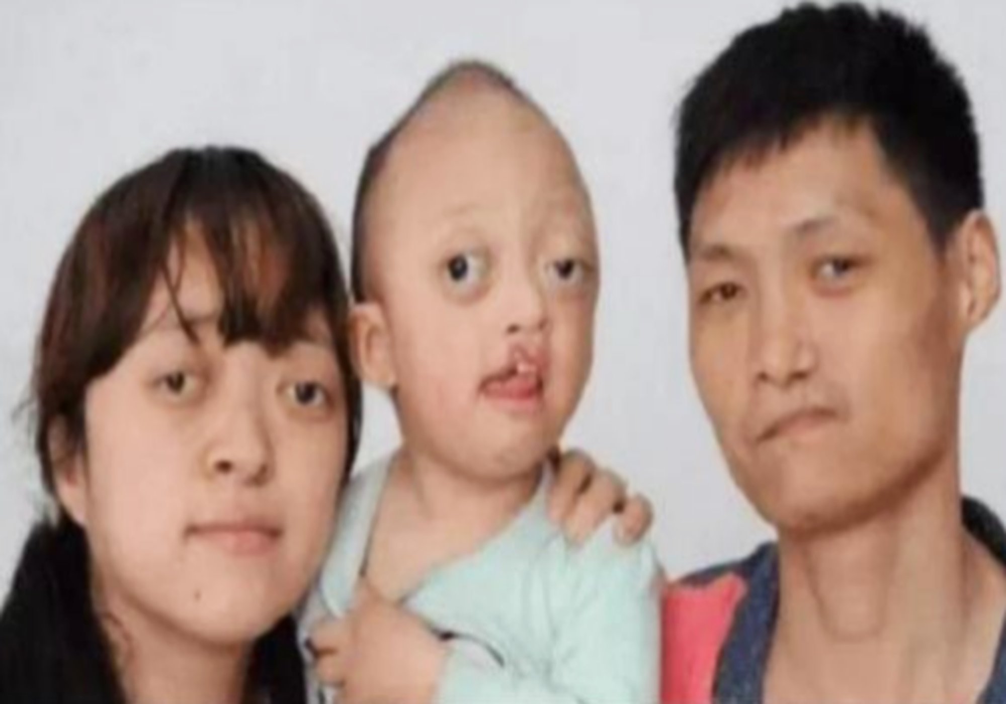 孩子长得丑的真正原因,孩子越来越丑是怎样引起的