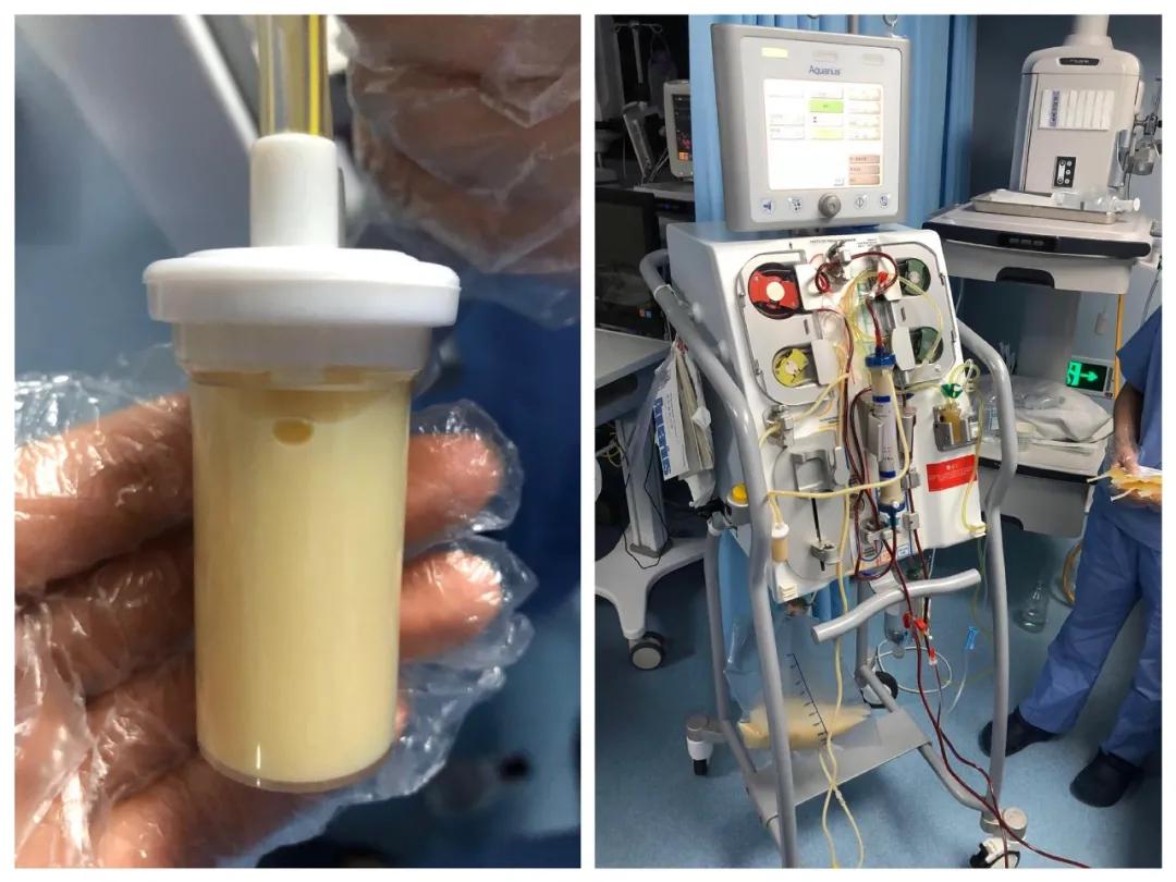 奇迹！从”死神“手中拽回的高危产妇