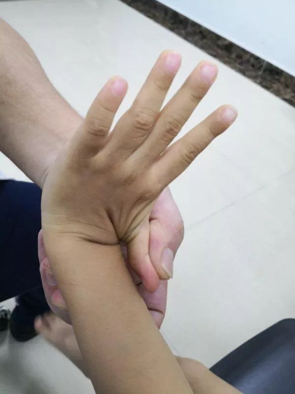 前交叉韧带松弛必须要做手术吗,韧带松弛轻重如何判断