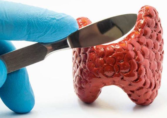 中西医对甲状腺癌病机、诊断与治疗方法解析