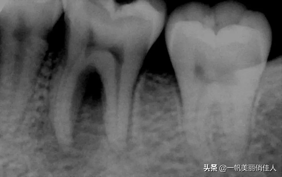 孩子越长越丑的真实原因,7岁以上孩子发展阶段