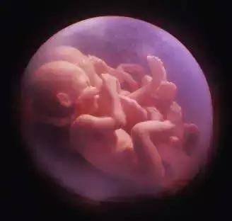 试管婴儿五个月引产,试管第三次成功又引产