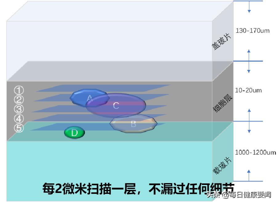 打过宫颈癌针需要查有没有抗体吗,35-45岁打宫颈癌疫苗最适合打几价