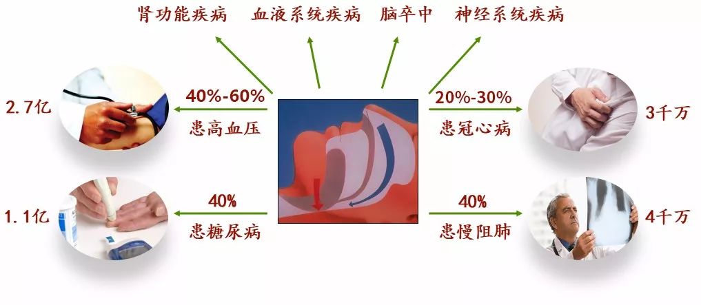 打鼾睡得香严重打鼾可致命,打鼾是睡得香吗