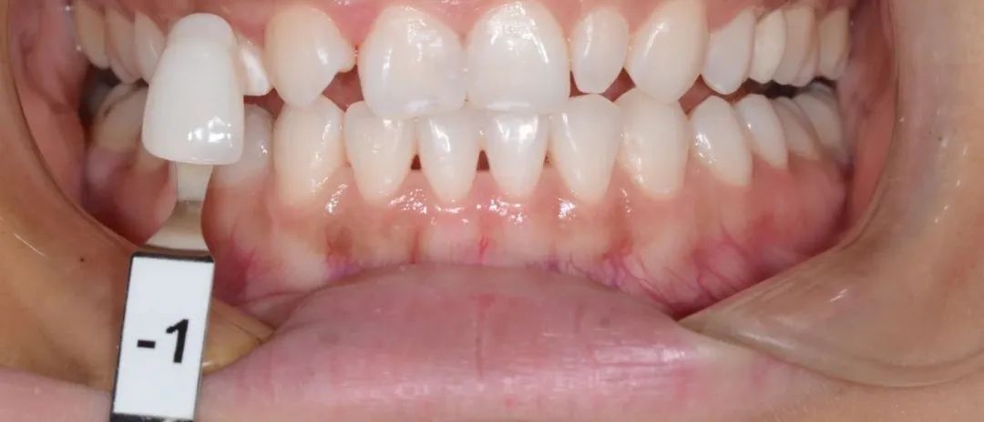 美白牙膏去牙黄真实有效测评,美白牙膏真实测评护牙效果