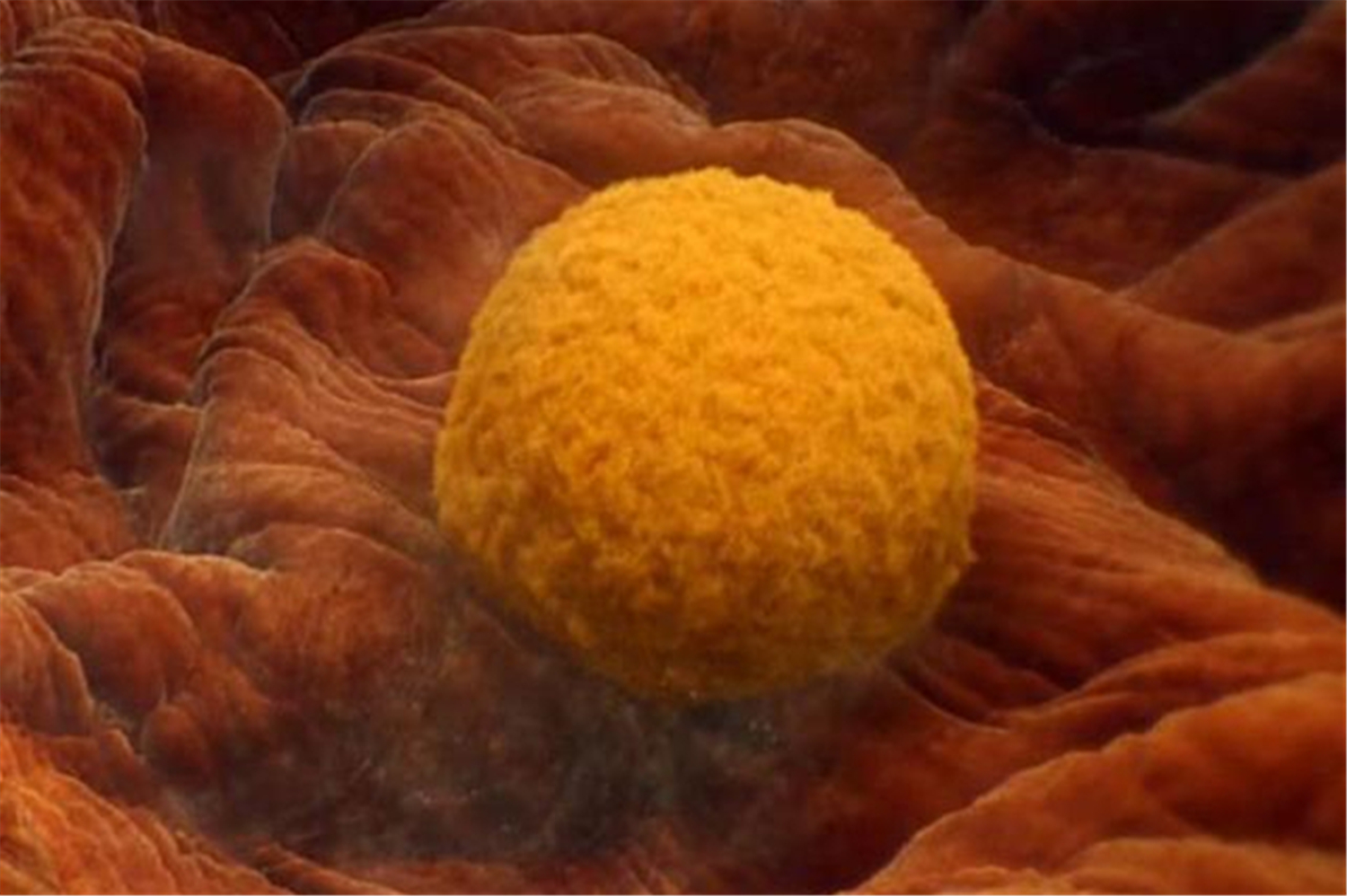 胎停育空孕囊生化什么原因,孕检发现胎儿有问题怎么办