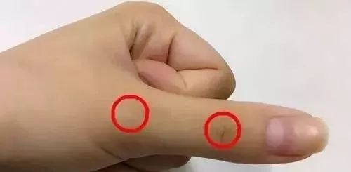 按手指哪个部位可治失眠,刮十指治便秘