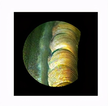 将内部细微之处通通展示给你---内窥镜