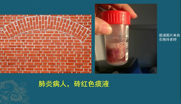 细菌性肺炎吐痰颜色加深,肺炎吐痰粉色需要治疗吗