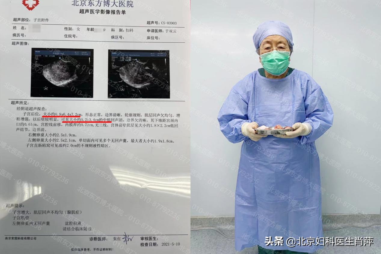 腺肌症怎么治？推荐腺肌症保宫术