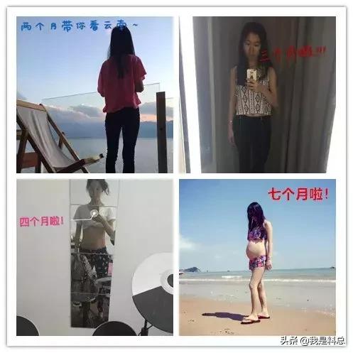 缝针不打麻药有多痛,侧切缝针到底打不打麻药