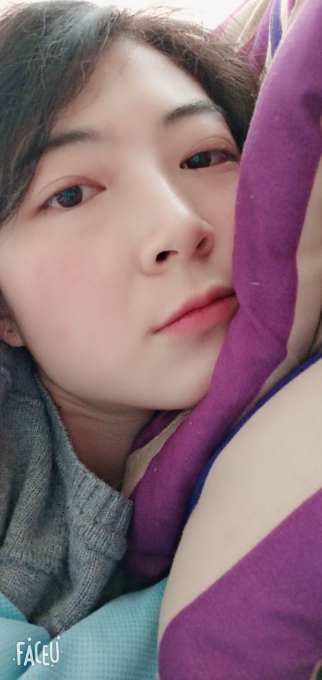 胎儿左足呈内翻状,左足马蹄内翻