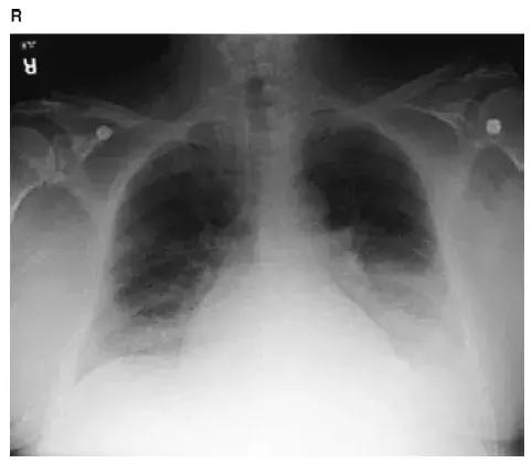 胸部影像解剖图谱书,胸部断层图谱