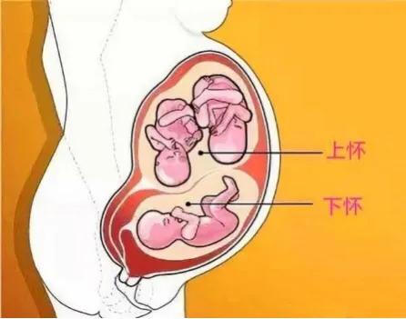 上怀下怀跟胎位有什么关系吗,上怀下怀哪个容易胎位不正