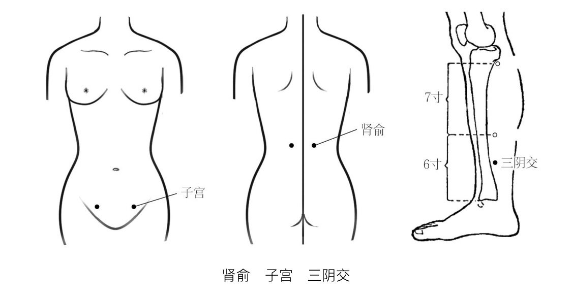 穴位按摩治更年期综合征,更年期适合埋线减肥吗
