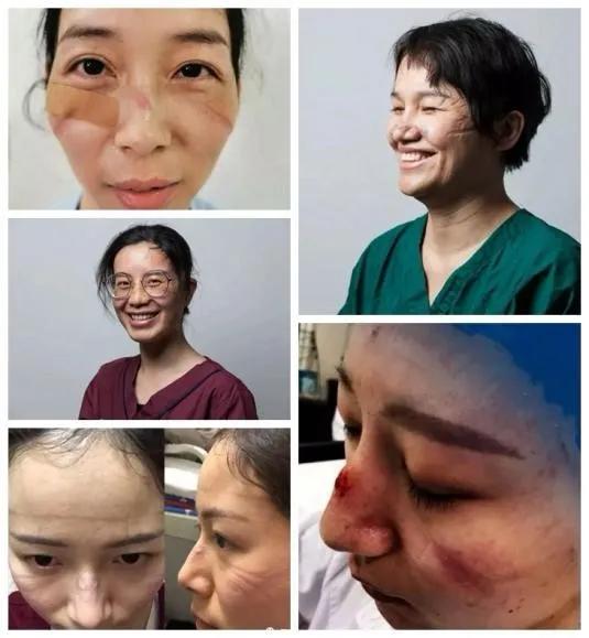 女医护战疫,战疫女医护