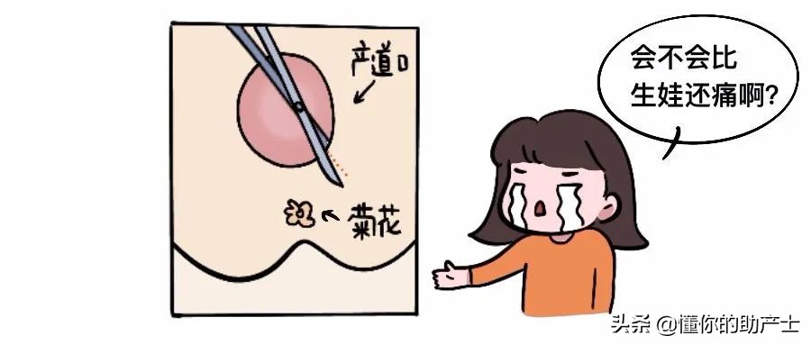 侧切可以要求打麻药吗,侧切不打麻药拆线有多疼