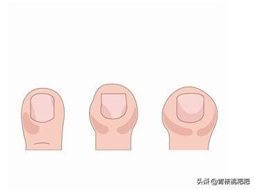 孩子吮吸手指是什么原因,喜欢吮吸手指是什么行为