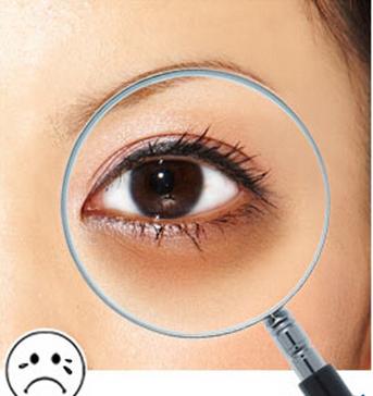 中医黑眼圈的形成原因,黑眼圈形成的原因和解决方法