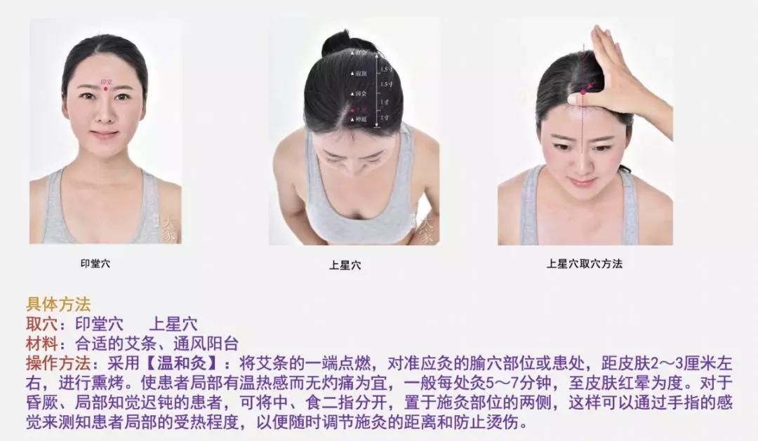 空调鼻炎,鼻炎怎么敷泥灸