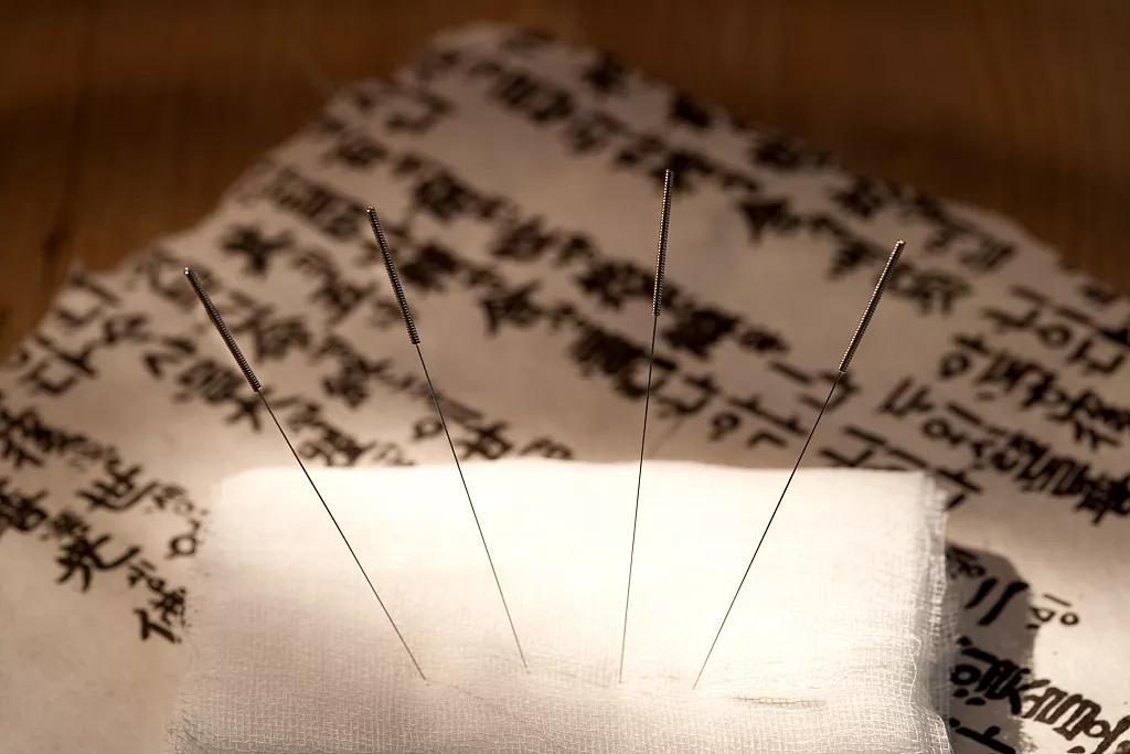 老魏祖传古法针灸,魏氏古法针灸李大成诊所