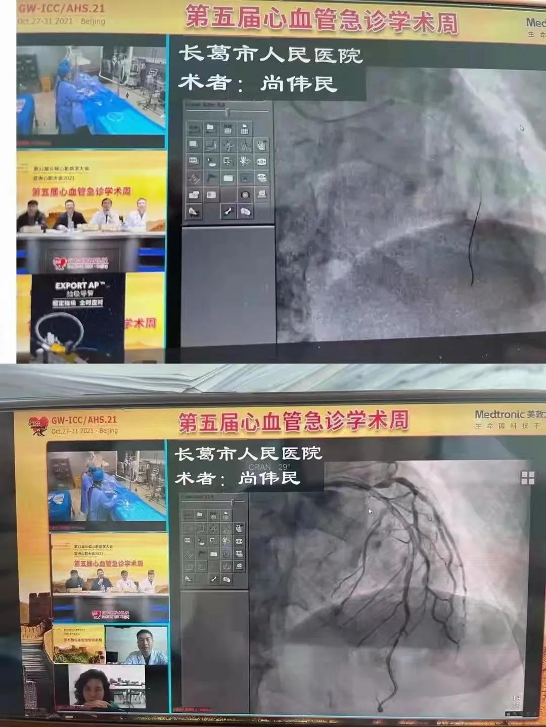 闀胯憶浜烘皯鍖婚櫌鏁戞彺鐜板満,闀胯憶鎵嬫湳