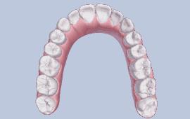明星牙齿矫正前后对比,明星牙齿矫正都用的什么矫正方式