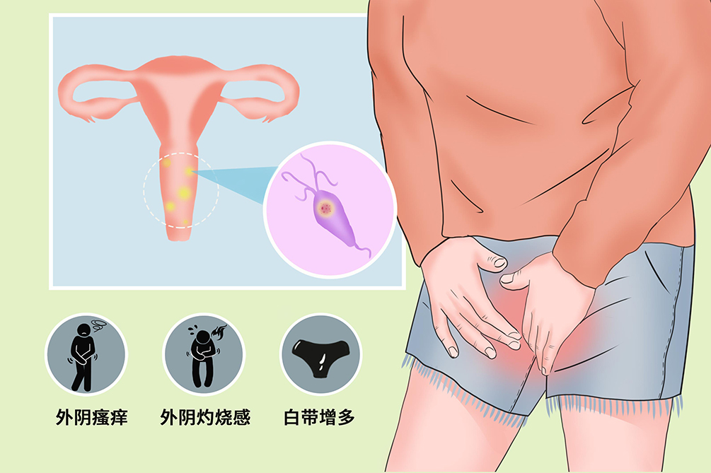 霉菌性妇科炎症最快治愈方法,妇科炎症治愈后多长时间怀孕