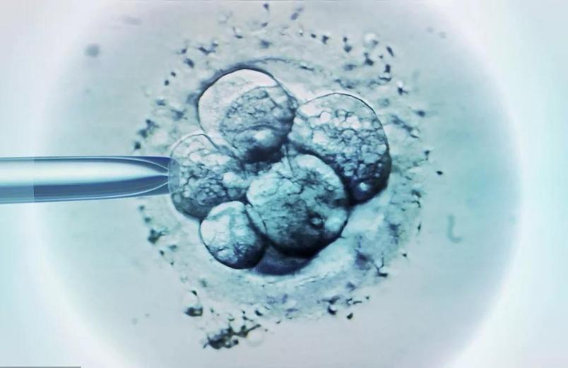 做试管婴儿的全部流程时间,做试管婴儿的艰难之路