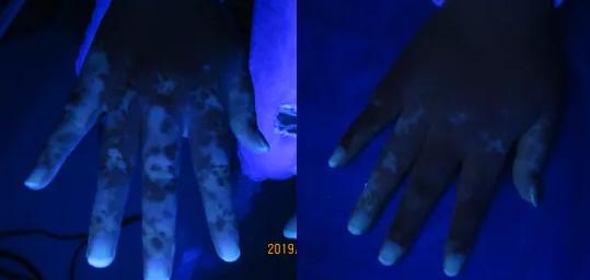 白癜风金句,白癜风常用语