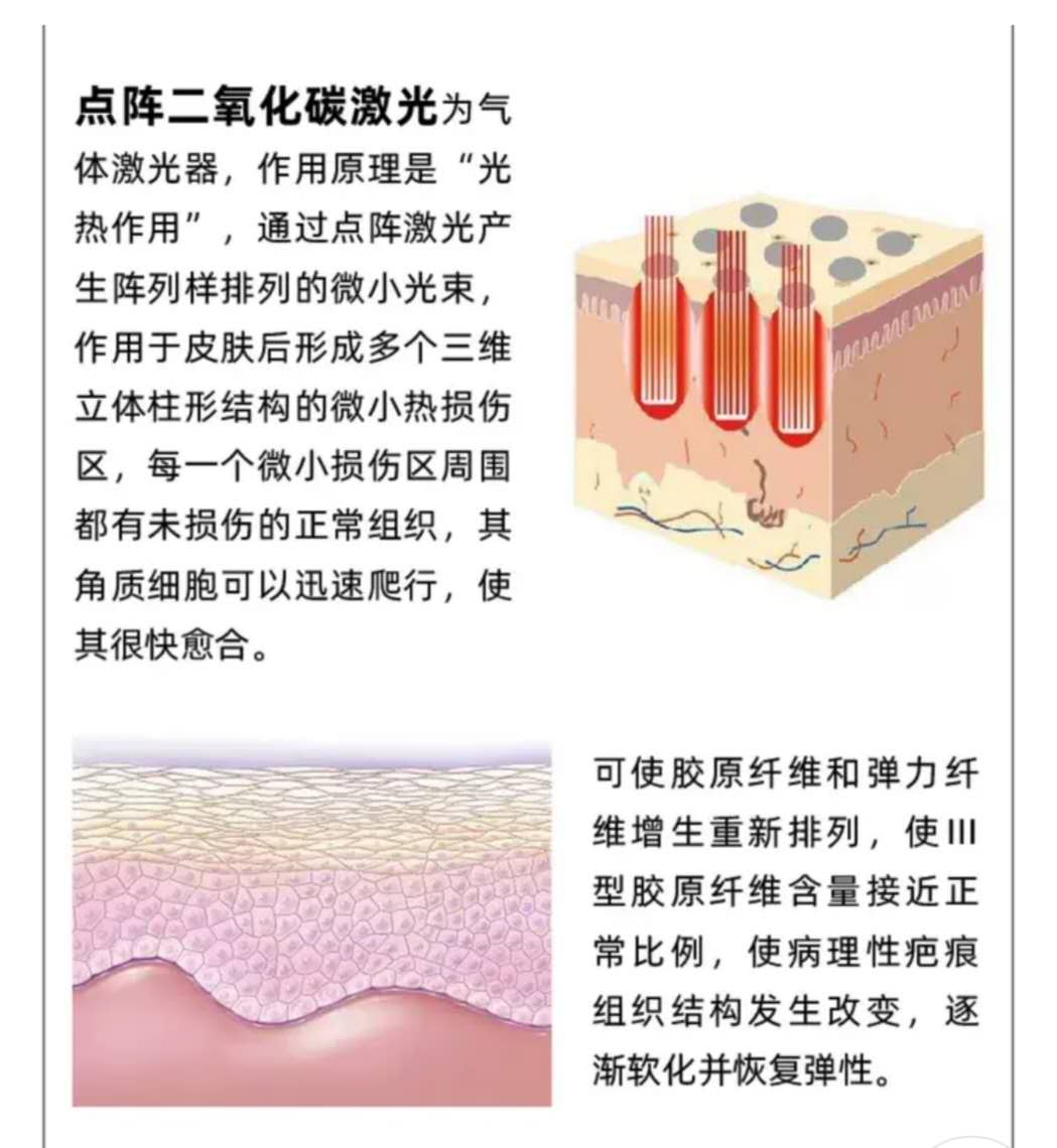 剖腹产难看的疤痕教你轻松美化,剖腹产疤痕恢复经历真实讲述