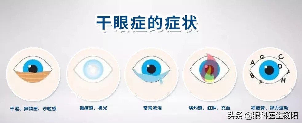 23岁女子经常彻夜玩手机患干眼症,看手机引起的干眼症患者自述