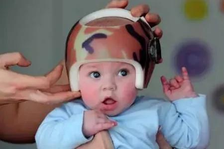 如何预防孩子扁头,怎么预防婴儿睡扁头