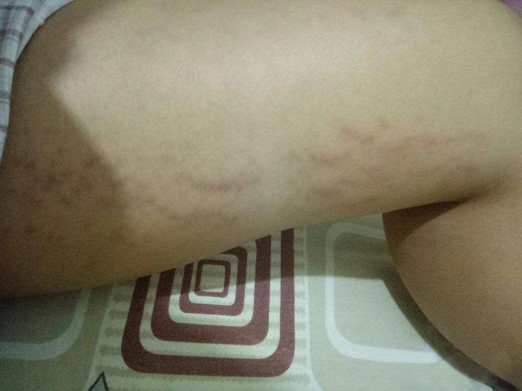 淡化妊娠纹的产品推荐,祛妊娠纹的产品哪个好