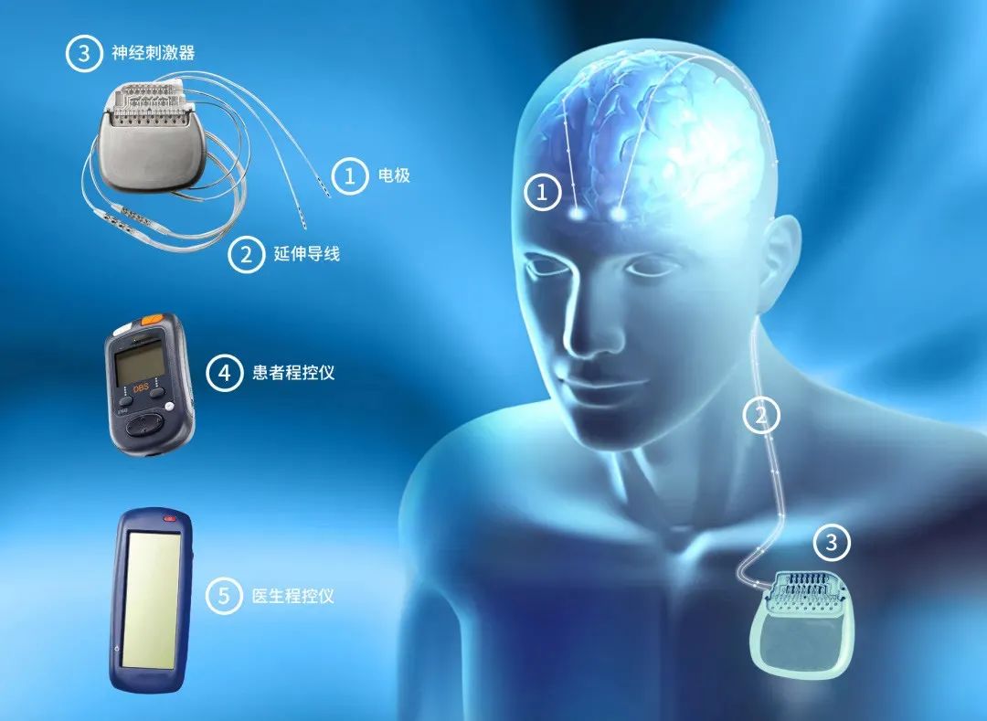 特发性震颤手抖用的筷子,手抖拿不稳筷子是怎么回事